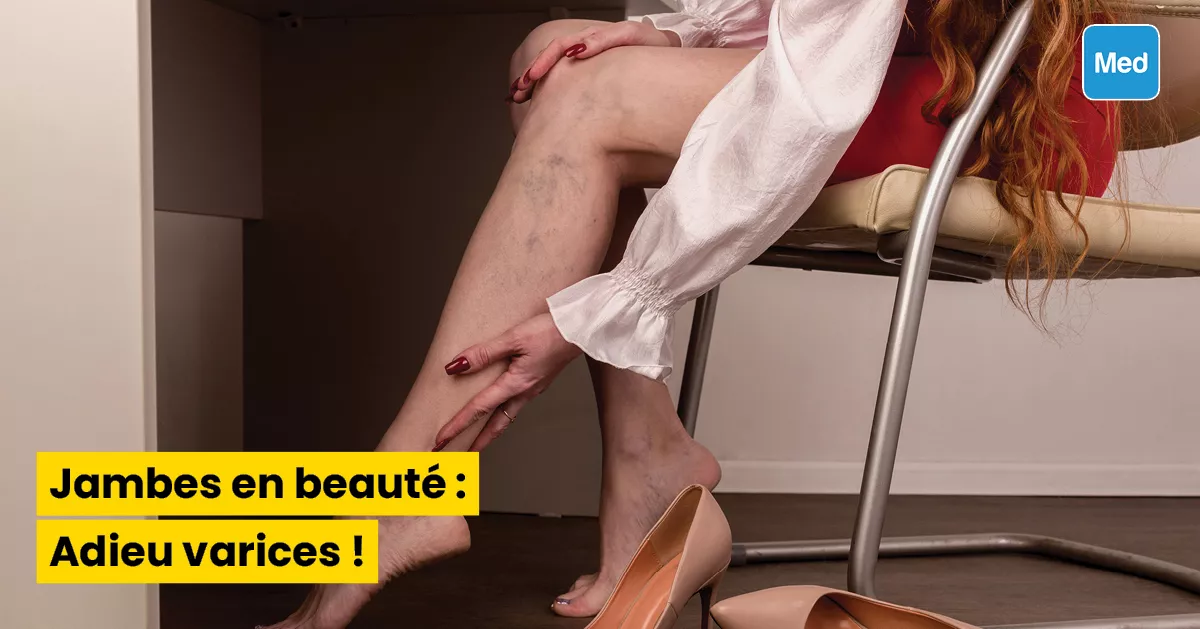 Jambes en beauté : Adieu varices !